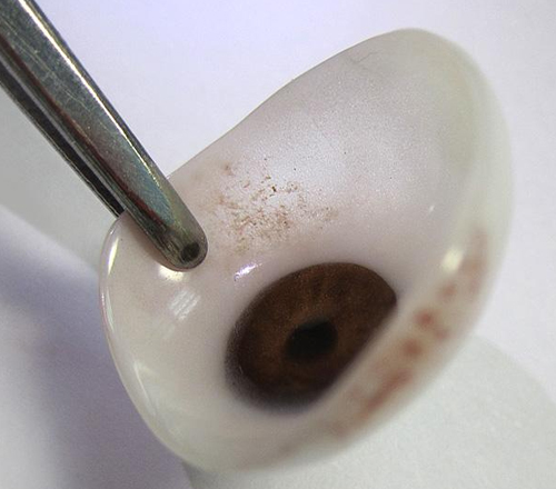 超薄型高分子義眼片